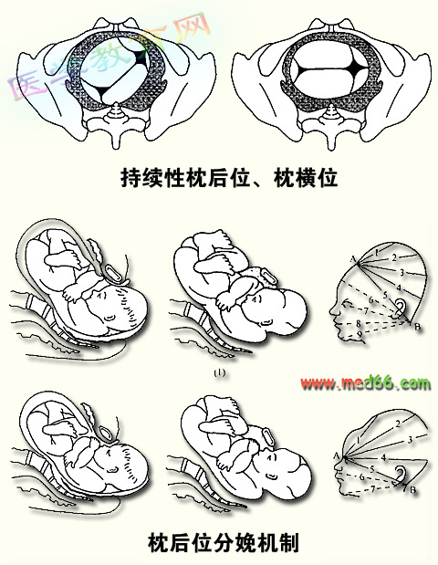 持续性枕左横逆时针旋转90,因为要把枕骨转到